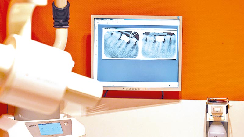 Wurzelkanalbehandlung